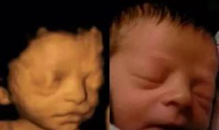 胎儿四维彩超照片