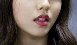 缩小鼻头手术多少钱